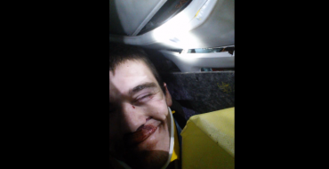 Guy Takes Video Selfie while being Cut from Car by Jaws of Life