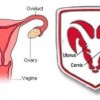 Dodge RAM logo head uterus vagina similarity